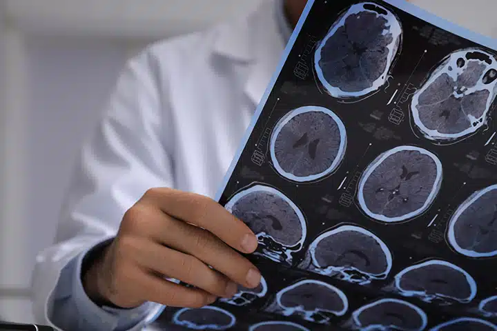 Doctor examining MRI images of patient with head injury