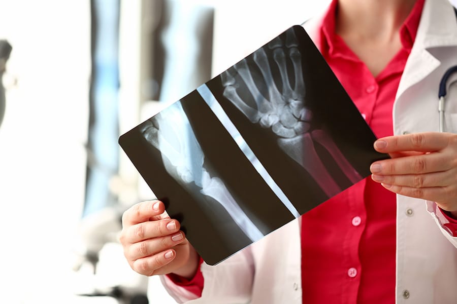 Permanent partial disability and carpal tunnel syndrome Female radiologist hold in hand x-ray film image aganist hospital office background. CT scan of bone health concept.