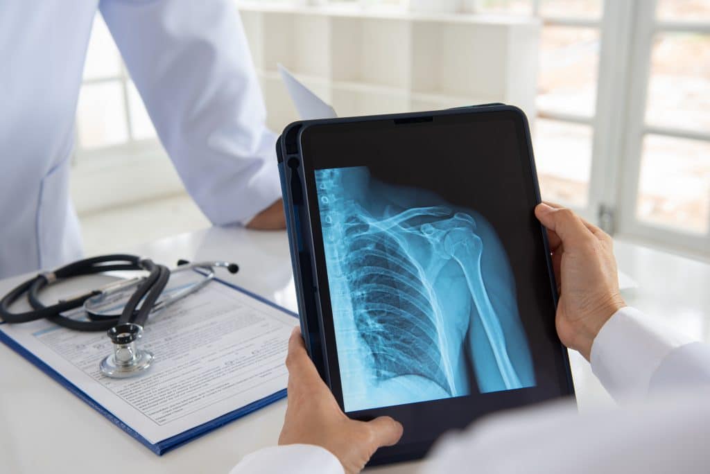 shoulder joint x-ray image on digital tablet with doctor team medical diagnose injuries of tendons and bones